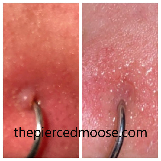 drop it - Oil Blend for Healing Problem Piercings singles 15ml